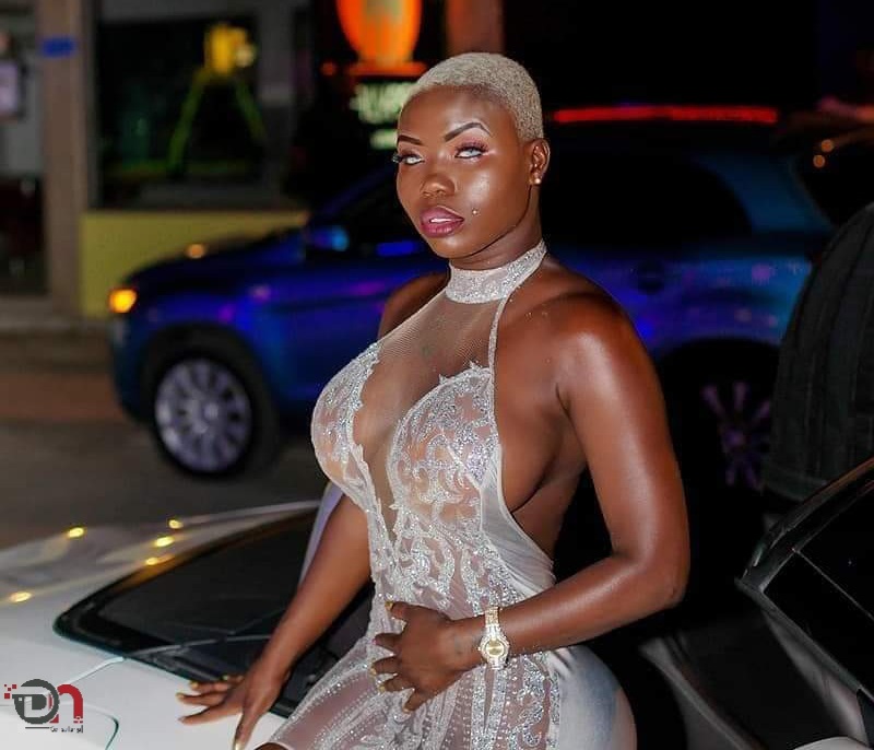 [Photos] la star togolaise Maria Mobil avant et après sa chirurgie esthétique