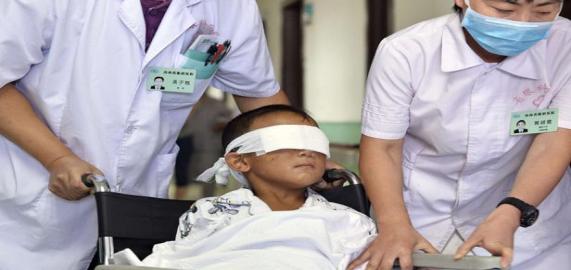 Chine: l’enfant énucléé a été opéré