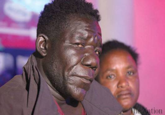 500$ et une vache pour l’homme le plus laid du Zimbabwe