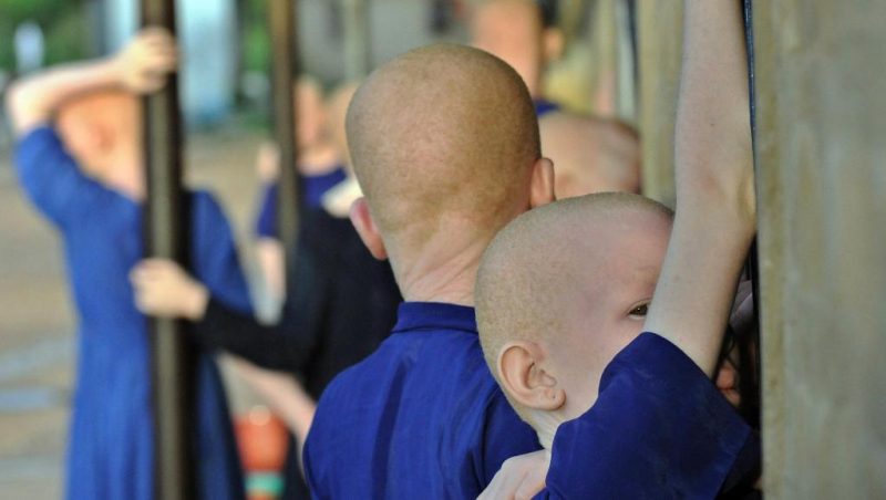 Burundi : le corps d’un jeune albinos retrouvé démembré