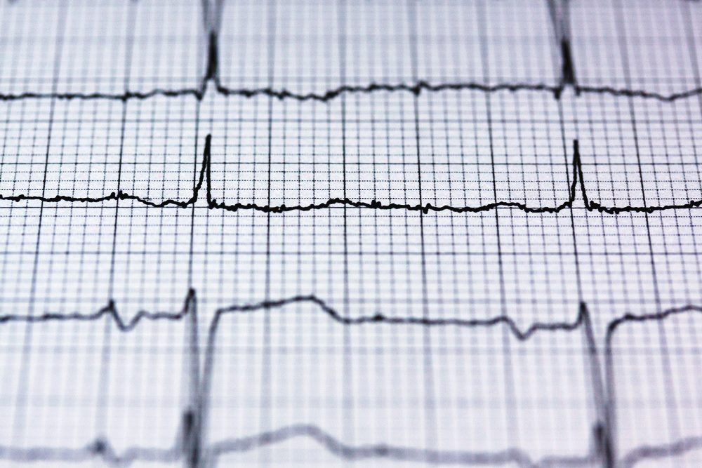 8 signes qui montrent que votre cœur ne fonctionne pas correctement