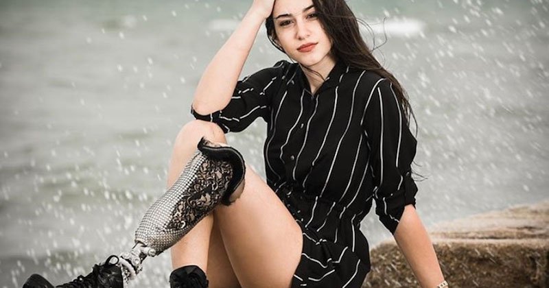 À 18 ans, et malgré son handicap, elle arrive 3e au concours Miss Italie 2018 (photos)