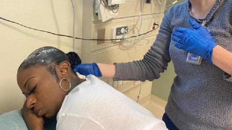A court de gel, elle utilise de la super glue pour se coiffer et finit à l’hôpital (vidéo)