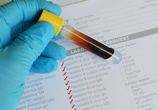 Appel à candidatures pour parcours Master en Biotechnologies à l’ESTBA de l’UL