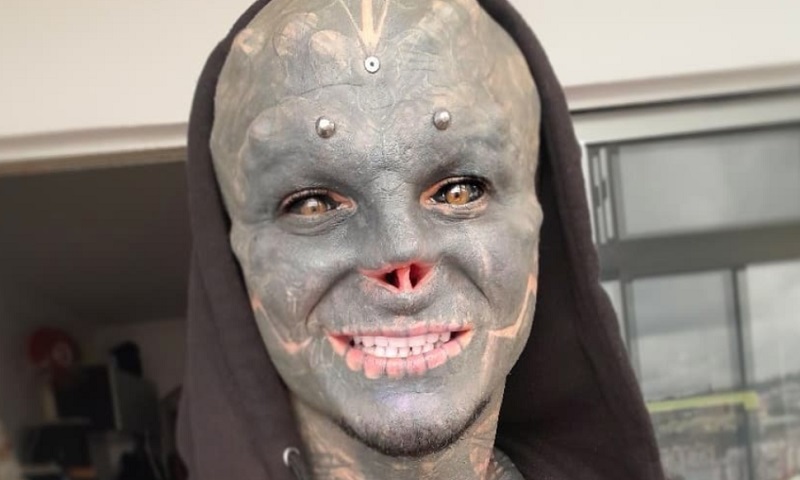 Après son nez, le « Black Alien » français se fait enlever la lèvre (photo)