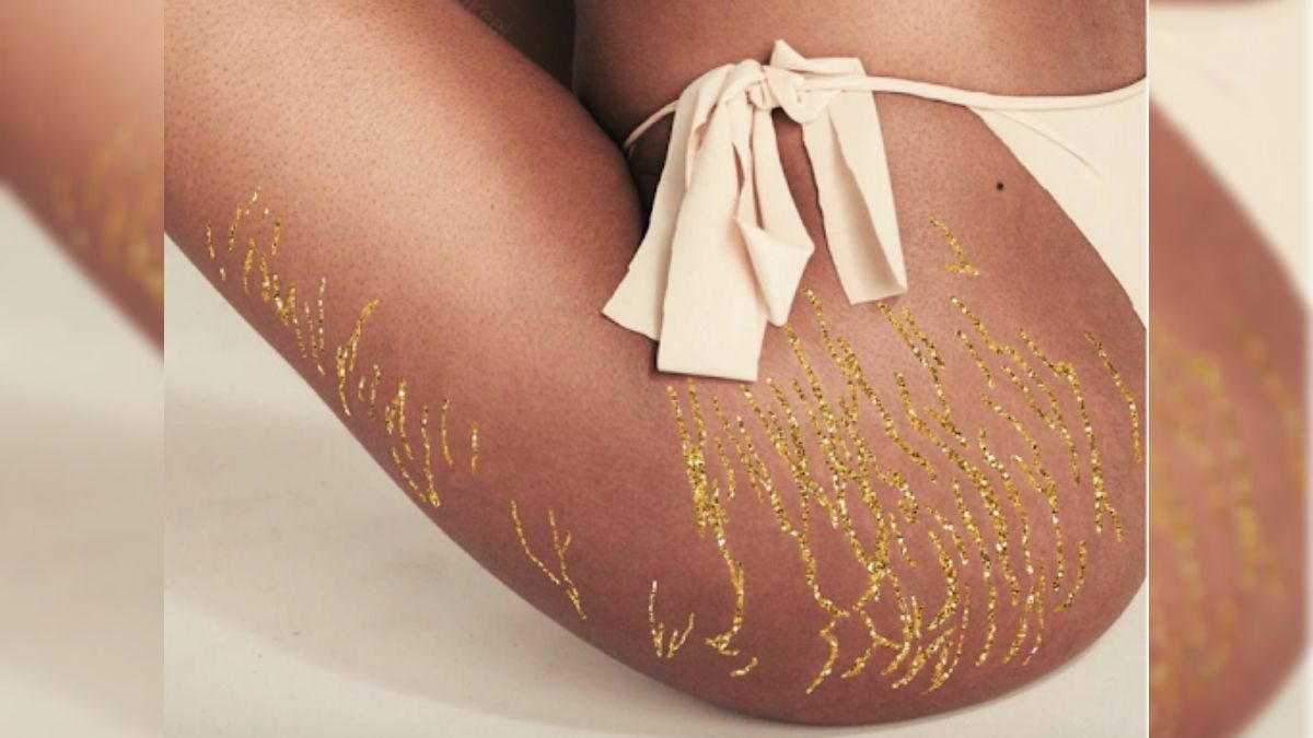 Beauté : cette célèbre chanteuse américaine assume ses vergetures et célèbre son corps (photos)
