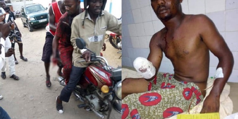 Bénin/Violences post-électorales : l’homme amputé retourne en prison