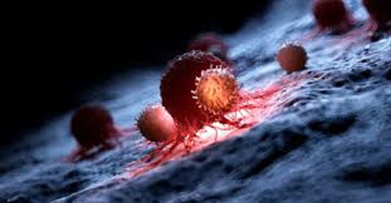 Cancer : Voici comment distinguer les faux symptômes des vrais