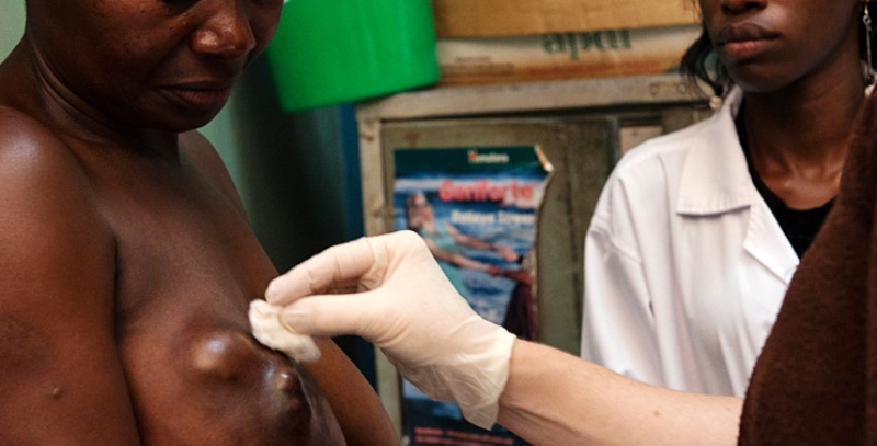 Cancer du sein, voici les signes à ne pas négliger