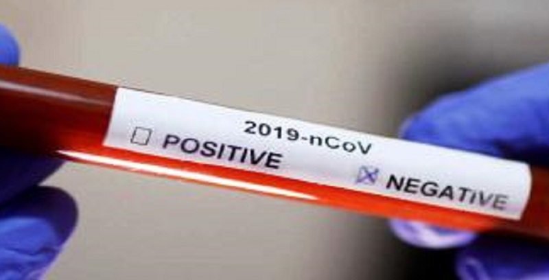 Coronavirus au Togo : 164 tests au Covid-19 revenus négatifs ce samedi 11 avril