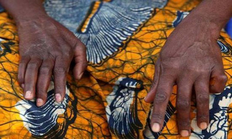 Coronavirus : comment arrêter de se toucher le visage avec les mains ?