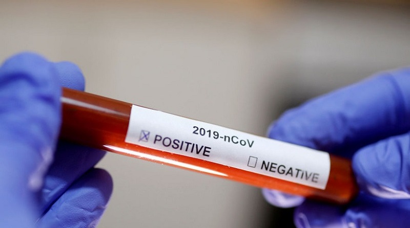 Covid-19 : un infirmier américain testé positif 8 jours après avoir été vacciné