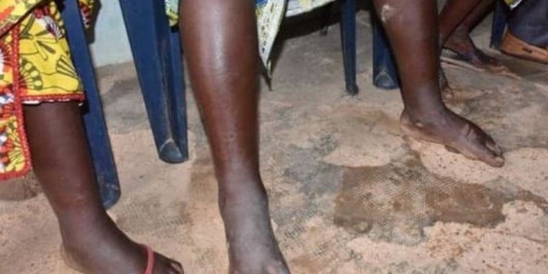Côte d’Ivoire : le département de Mankono attaqué par une mystérieuse maladie