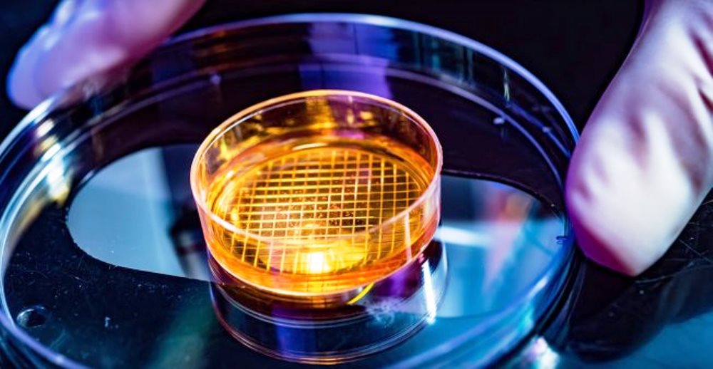 Des cellules créées en laboratoire laissent entrevoir la guérison des malades du diabète
