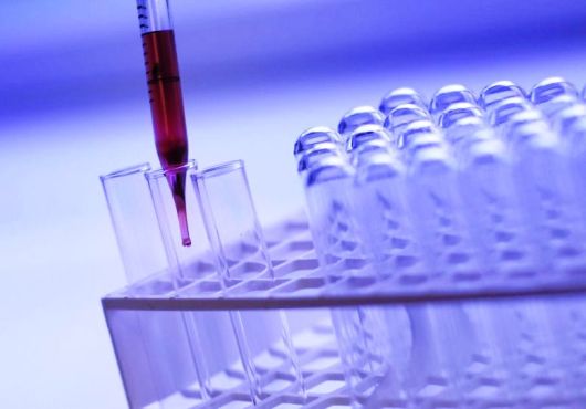 Des chercheurs conçoivent un test de dépistage rapide du cancer de la prostate
