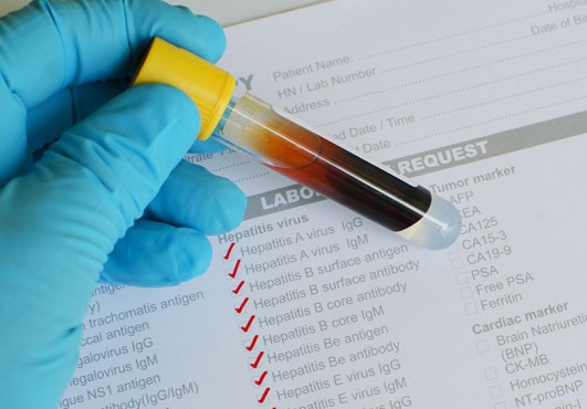Liberia : un nouveau cas de virus d’Ebola détecté