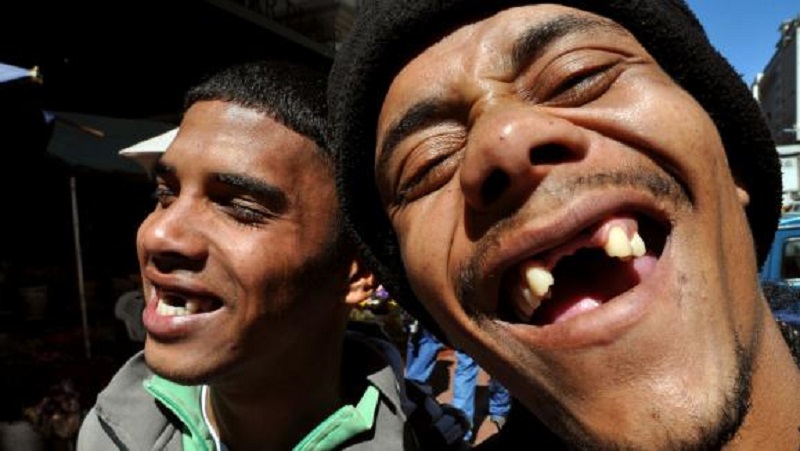 Afrique du Sud : on se fait arracher les dents de devant pour se sentir ‘plus beau et plus séduisant’