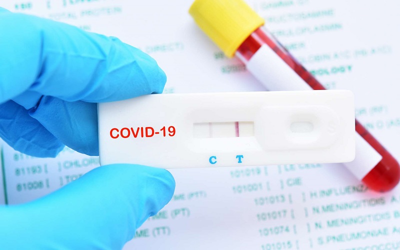 France / Covid-19 : de faux certificats de tests vendus à des « clients » voyageant vers l’Afrique