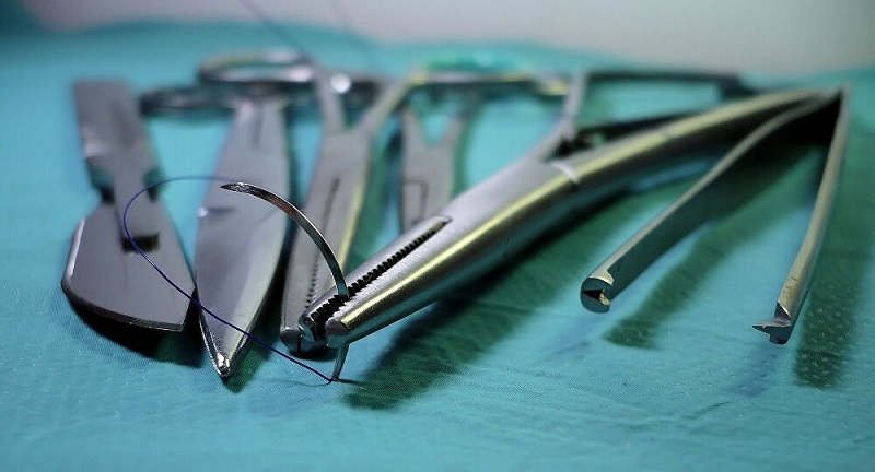 France : un chirurgien soupçonné d’avoir utilisé une centaine de patients comme «cobayes»
