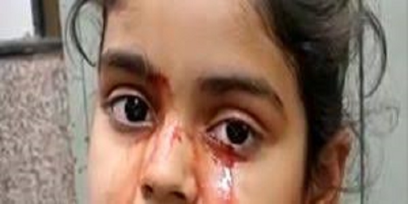 Inde : les larmes de sang d’une jeune fille intriguent les médecins