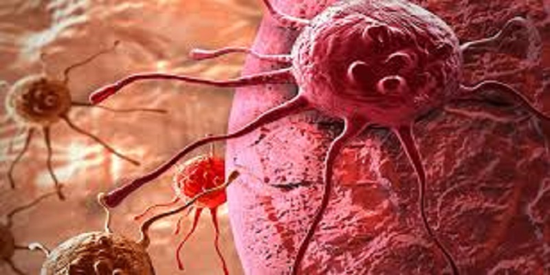 Le cancer pourrait être diagnostiqué par un système de vision par ordinateur utilisé dans l’aviation