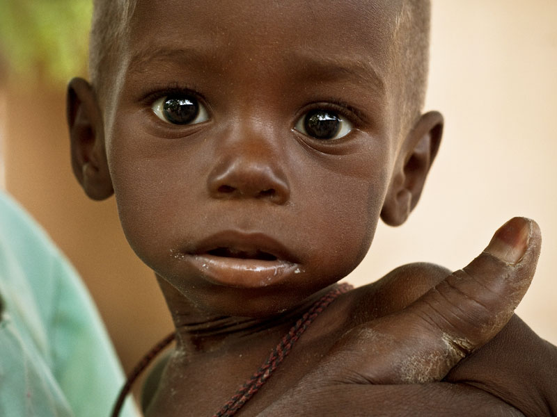 Lutter contre la sous-alimentation au Togo: une priorité du gouvernement!
