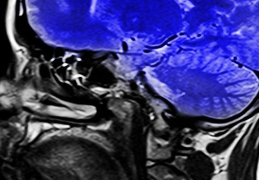 Les petites habitudes quotidiennes qui ralentissent notre cerveau