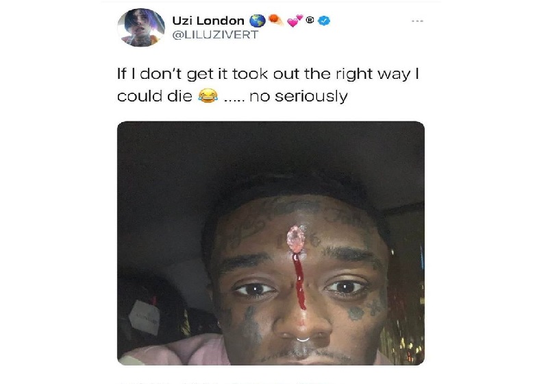 Lil Uzi Vert sur son diamant au front : « Je pourrais mourir si je ne le retire pas »