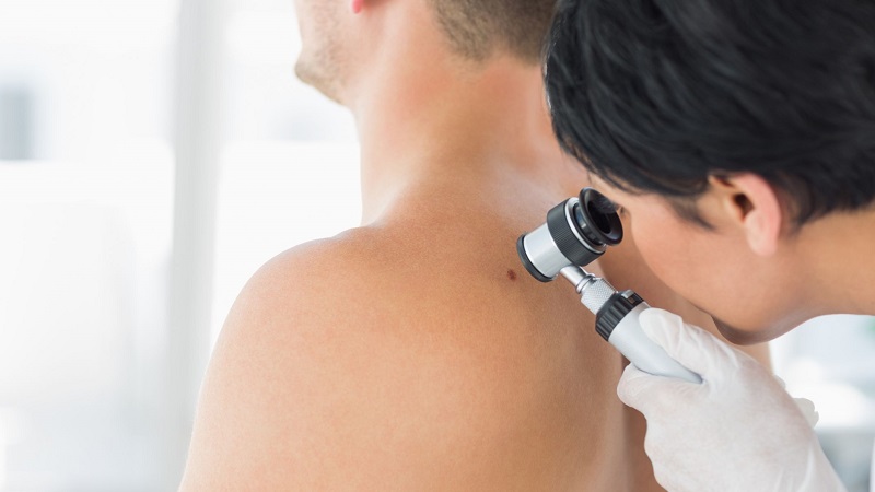 L’intelligence artificielle contre le cancer de la peau