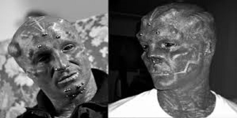 Modification corporelle extrême : après les oreilles, Black Alien se fait retirer le nez