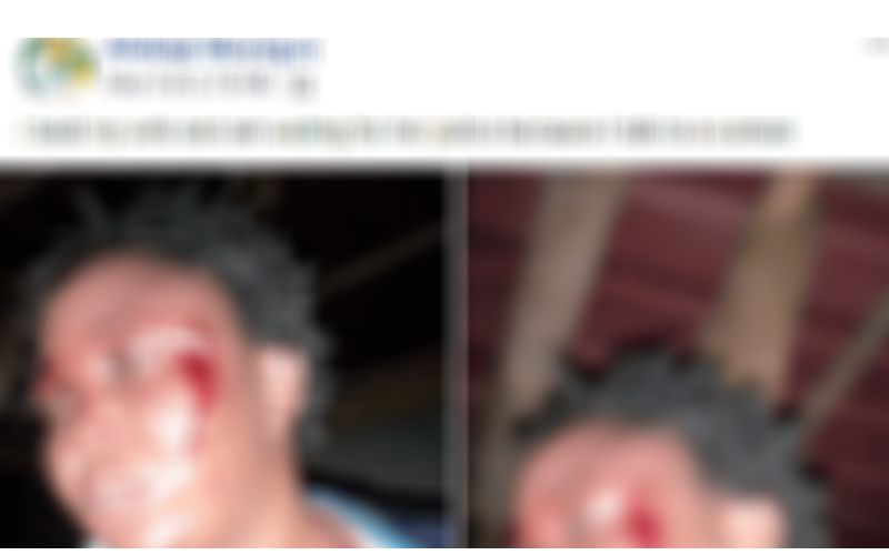 Nigeria : un homme bat sa femme et publie  les photos sur  Facebook