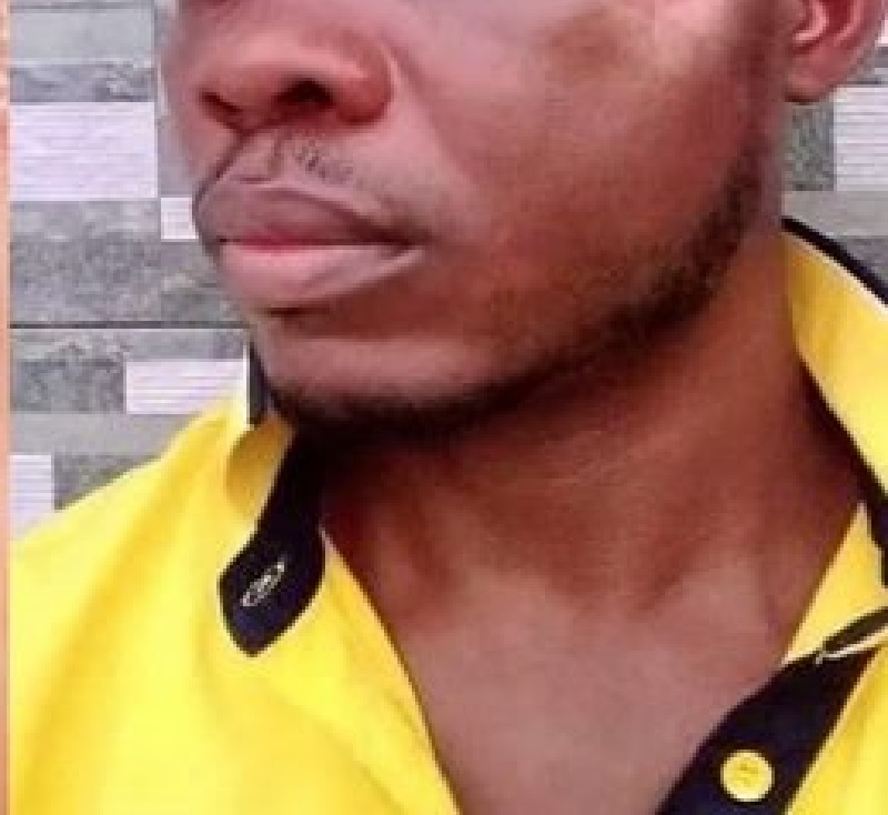 Nigeria : un homme vomit la balle logée dans sa tête des mois après