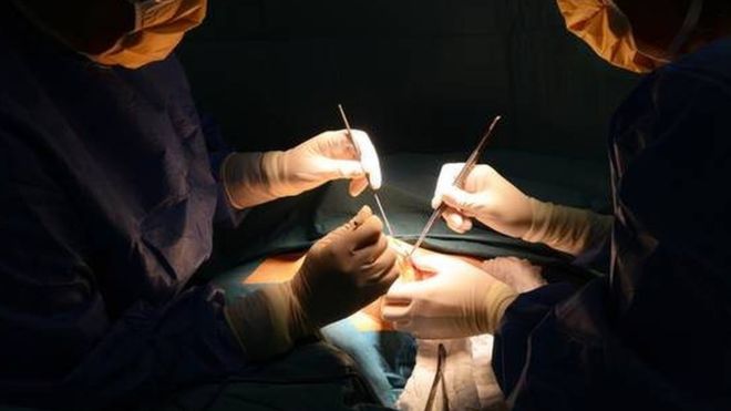 Incroyable ce que les médecins ont extrait de l’estomac de ce patient : un vrai magasin à outils !