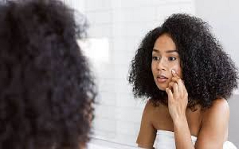 Points noirs : pourquoi ils apparaissent et comment les enlever