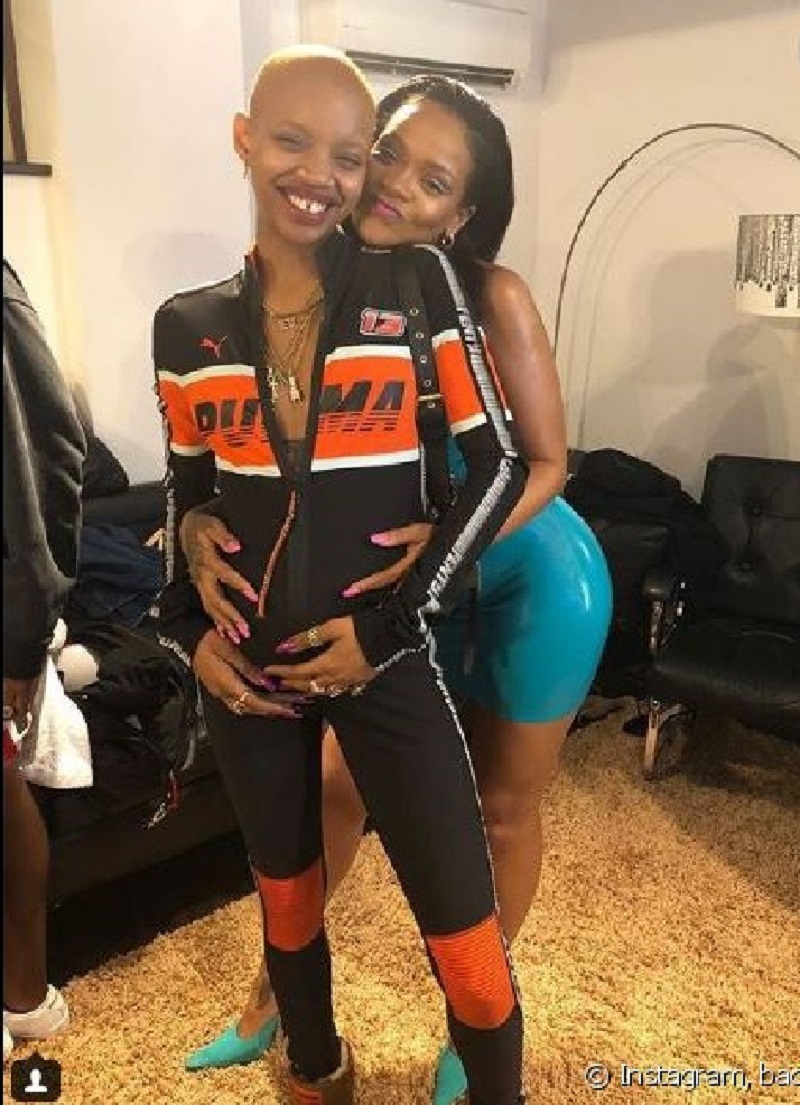 Slick Woods : La chouchoute de Rihanna, défigurée après une crise