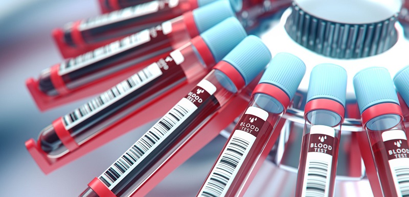 Santé : un test sanguin capable de détecter la dépression et les troubles bipolaires