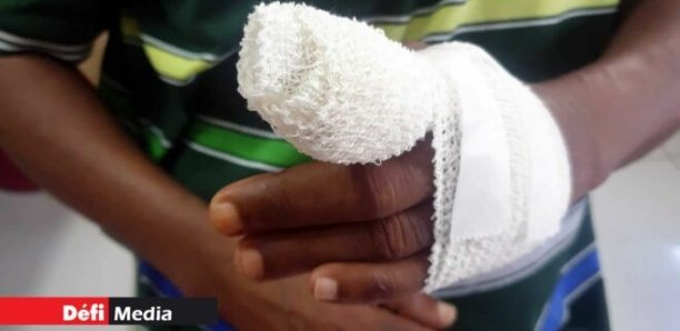 Sénégal : battue par sa maîtresse, une élève perd son doigt