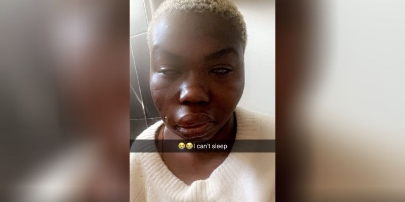 Stars : Maria Mobil copieusement tabassée par son copain ? (Photo)