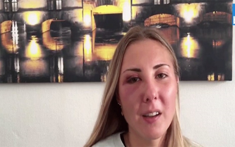 Strasbourg : une étudiante insultée et frappée parce qu’elle portait une jupe