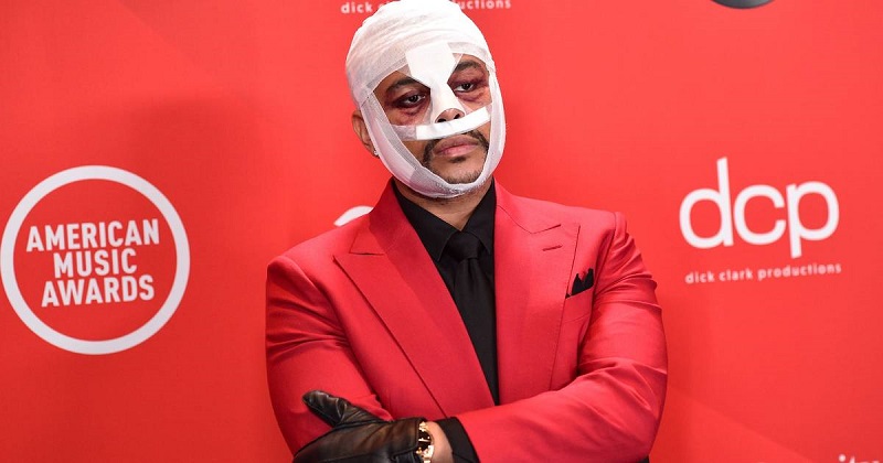 The Weeknd : la star révèle pourquoi son visage est bandé et tuméfié depuis des mois