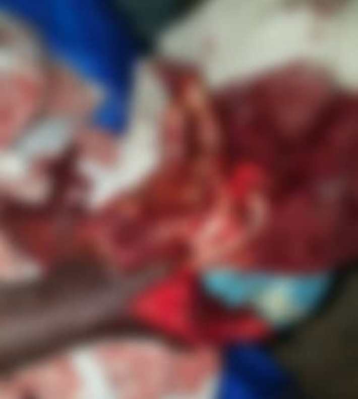 Togo-Drame/Lomé : il entre en 2019 sans sa main droite à cause des pétards (‘bandit’)…prudence