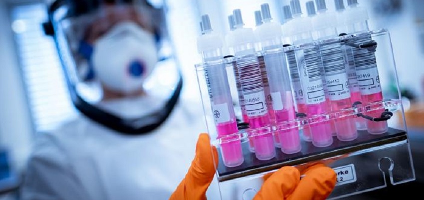 Togo : le test de dépistage du coronavirus sera désormais payant