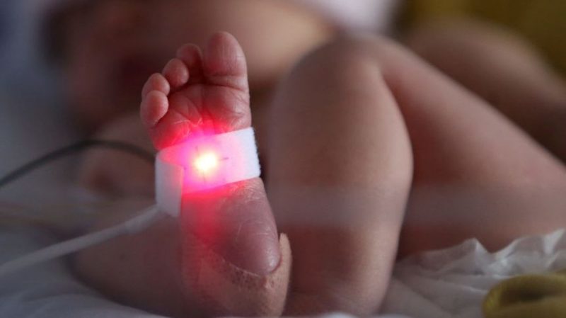 Un bébé avec l’ADN de 3 personnes naît en Grèce
