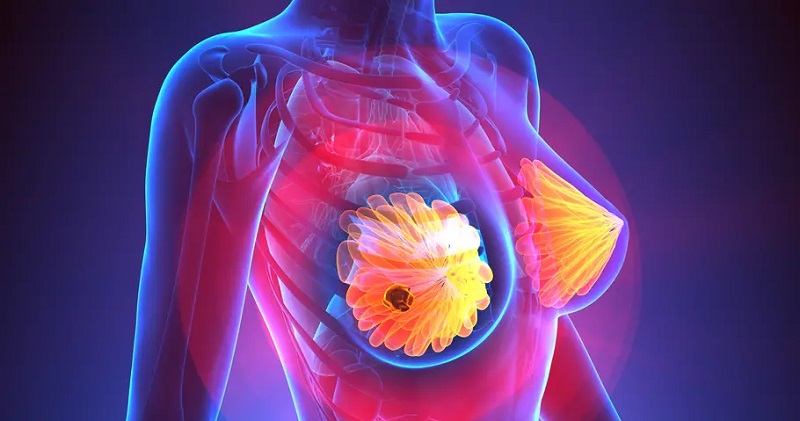 Un chercheur américain évoque une cause d’un des cancers les plus répandus