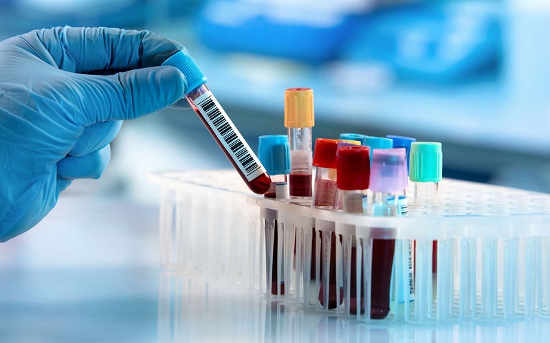 Des chercheurs établissent un lien entre le groupe sanguin et le risque d’infection au coronavirus