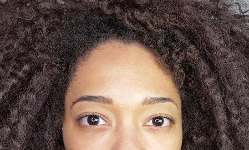 Une dermatologue met en garde contre ces gonflements dangereux sur le visage