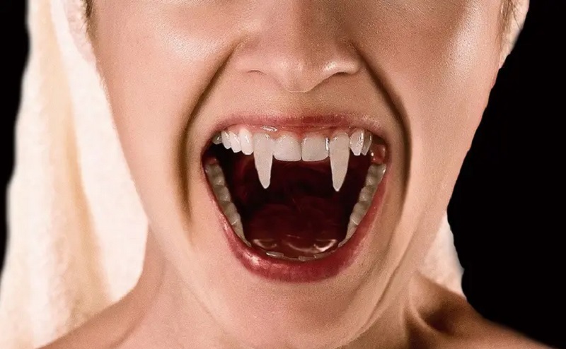 Une femme se retrouve aux urgences à cause de ses dents de vampire