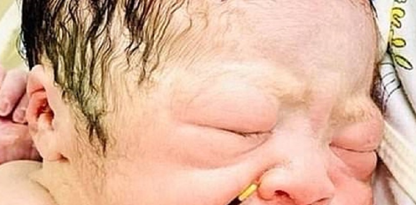 [Photo] Un bébé attrape le stérilet de sa mère dans la main à sa naissance