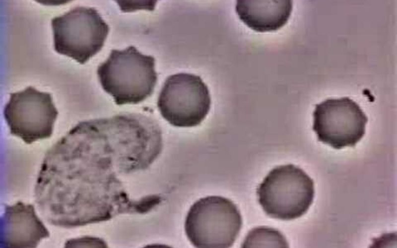 [Vidéo] Comment le globule blanc court après une bactérie dans notre corps