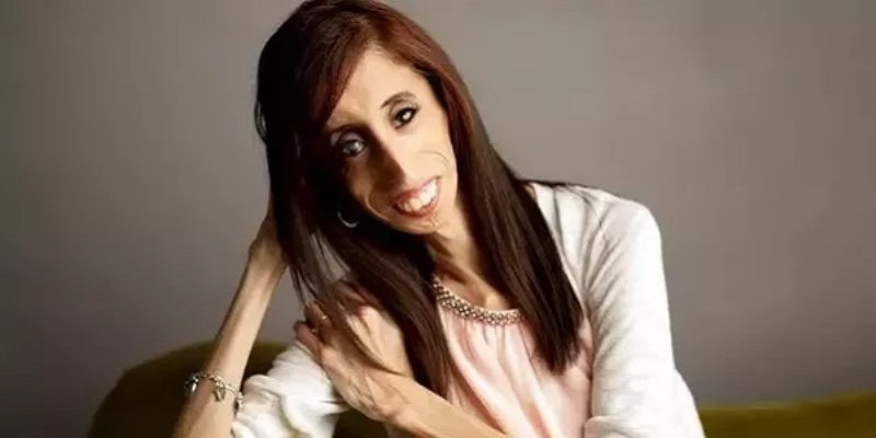 Voici 7 citations inspirantes de Lizzie Velasquez, la femme qualifiée de ‘la plus laide du monde’